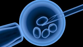 The WHO has called for "equal access" to IVF. Photo: centreforivf.in