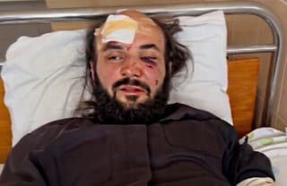 UOC priest Vitaliy Honcharuk, beaten by OCU militants. Photo: UOJ's Ukrainian branch (SPZh)