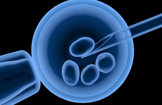 The WHO has called for "equal access" to IVF. Photo: centreforivf.in