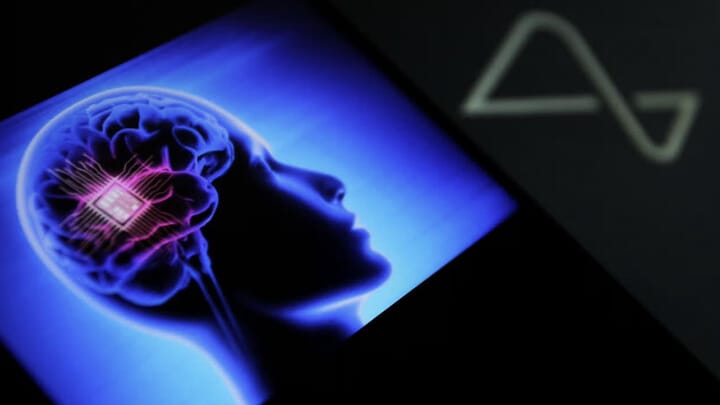 Image of a chip in the head. Photo: theguardian.com