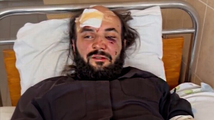 UOC priest Vitaliy Honcharuk, beaten by OCU militants. Photo: UOJ's Ukrainian branch (SPZh)