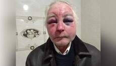 Zadubrivka: OCU supporters severely beat an elderly parishioner of UOC