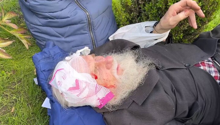 A UOC monk injured by militants in Cherkasy. Photo: Cherkasy Eparchy