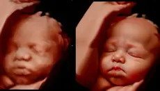 South Carolina House Advances Bill to Block Mail-Order Abortion Drugs